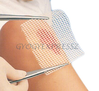 GRASSOLIND 20 x 20 cm kenőcstüll 10 db GRASSOLIND 20 x 20 cm kenőcstüll 10 db